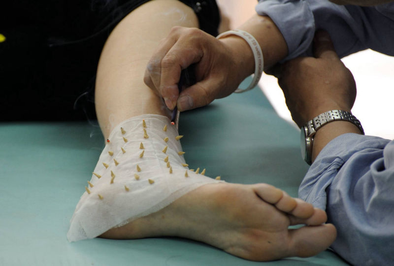 Moxibustion japonaise pour les douleurs 