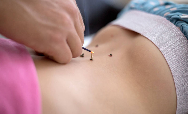 Moxibustion japonaise pour les douleurs 