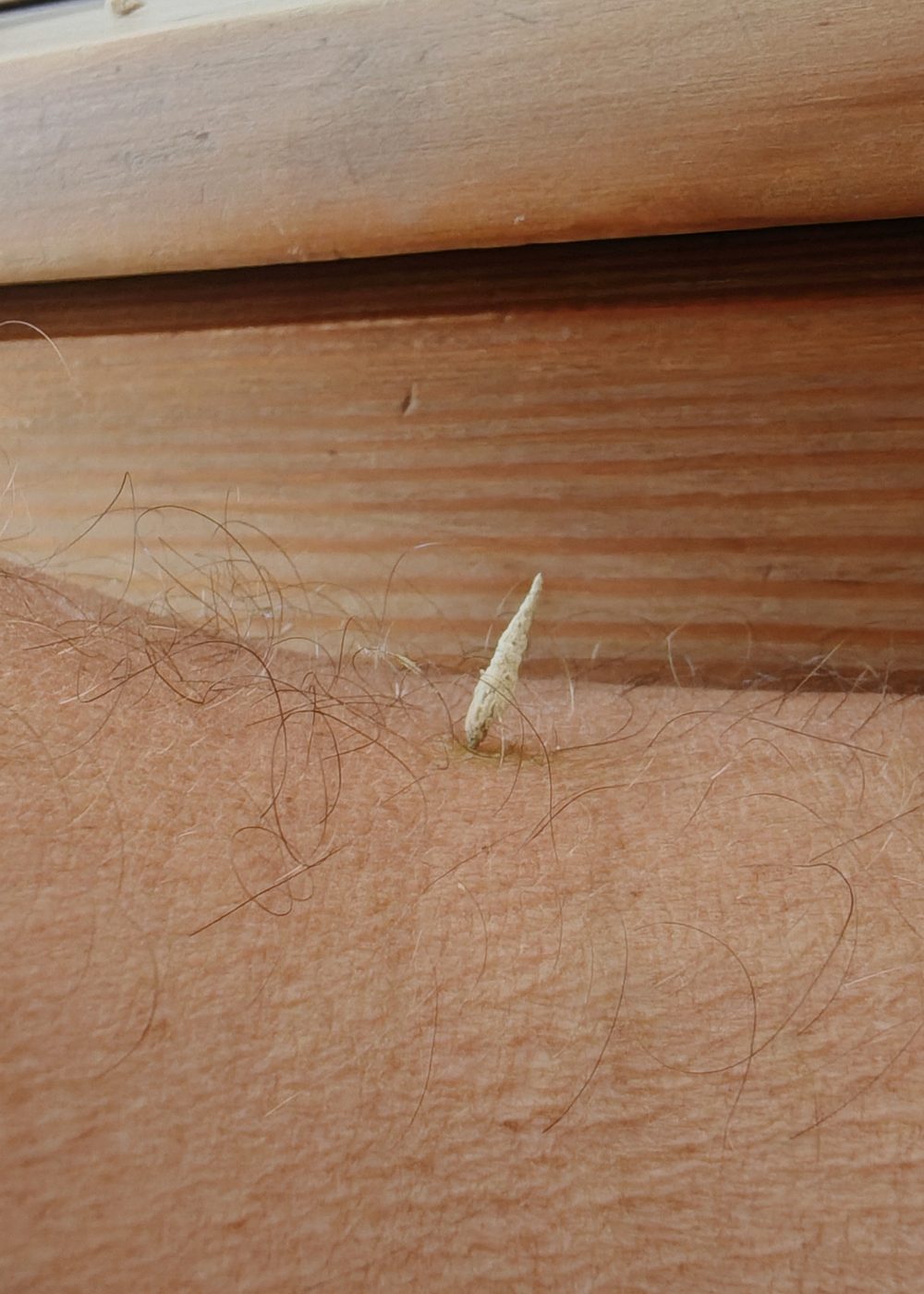 Cône de moxa grain de riz — technique Tonetsokyu, style Fukaya